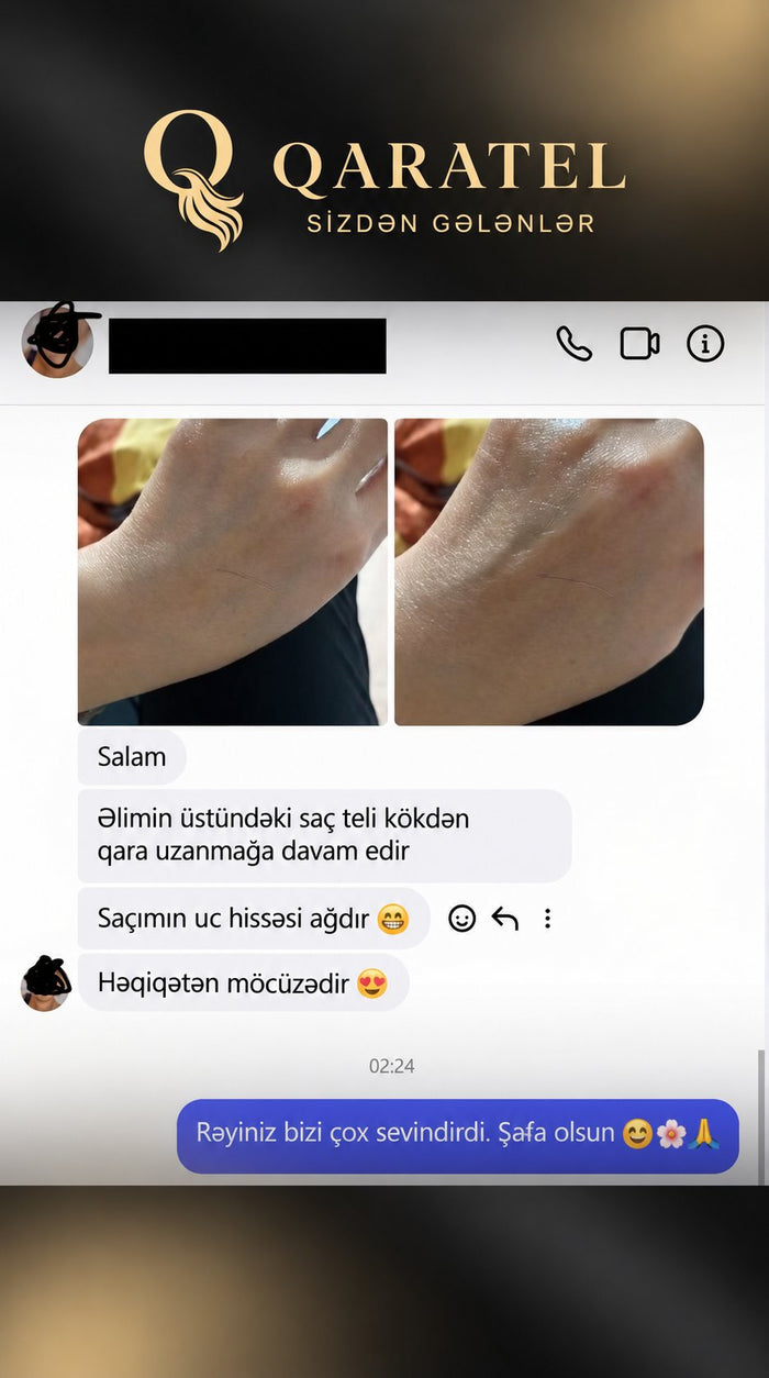 Müştəri rəyi 14